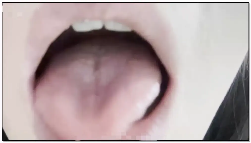 布鲁比呐呐 牙套妹的口腔检查插图