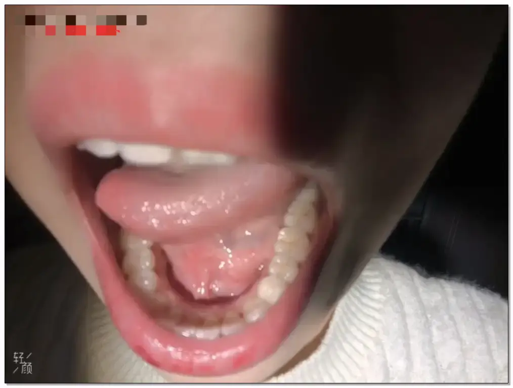 菜菜cyl不好吃ASMR 口腔检查 🀄插图