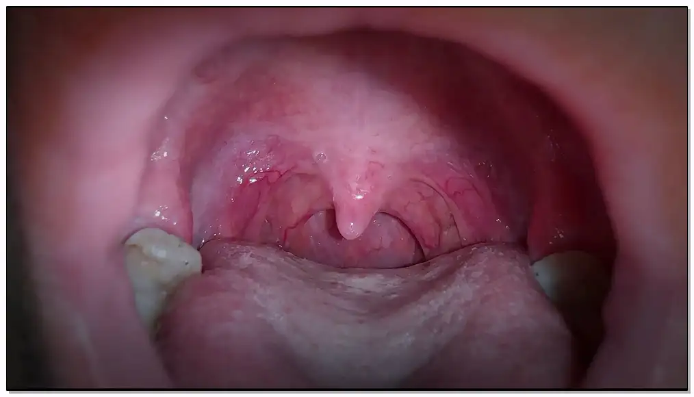 Nana困薯ASMR  口腔展示👄酸奶插图