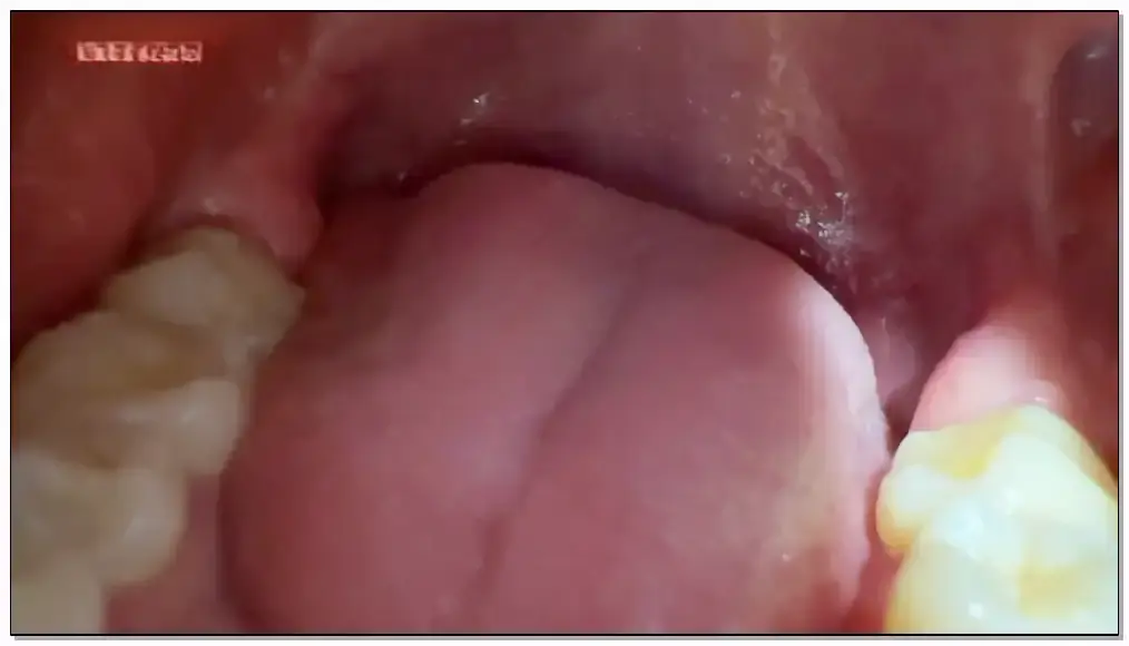 小灿助眠 蛇腰呑插图